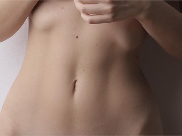 ¿Cuál es la diferencia entre abdominoplastia y liposucción?