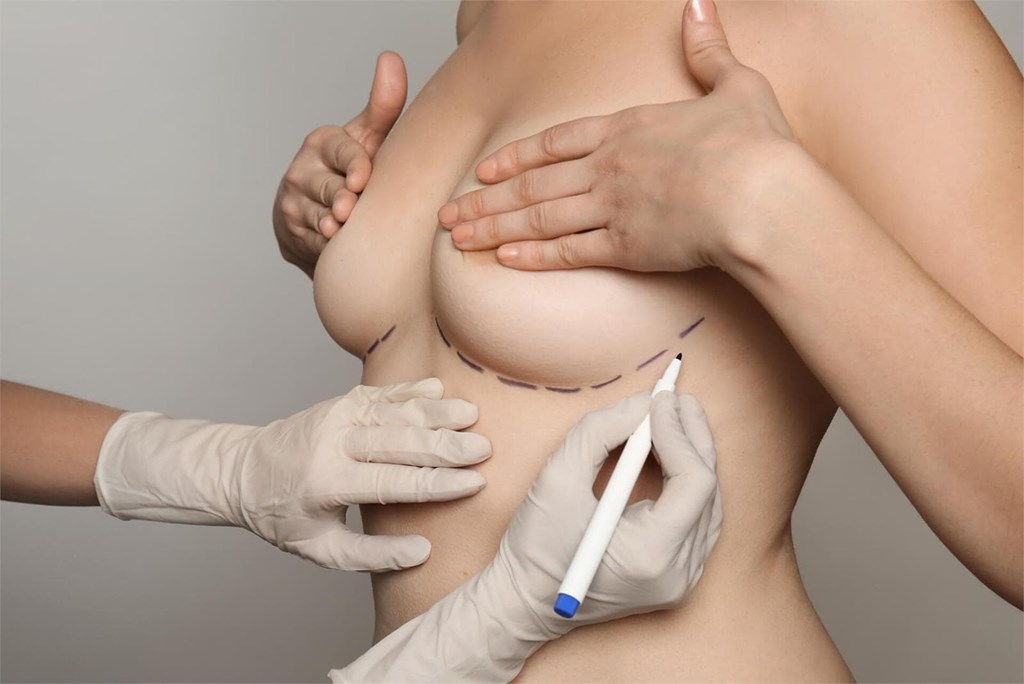 Preguntas frecuentes sobre la cirugía de aumento de senos